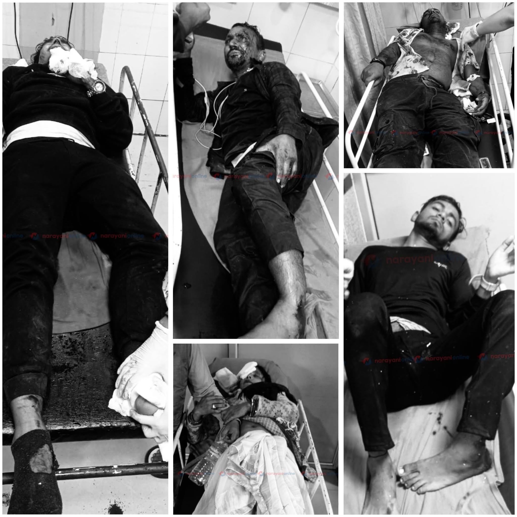 चितवनमा दुईवटा बस र एउटा ट्रक ठोक्किदा ३३ जना घाइते (विवरणसहित)